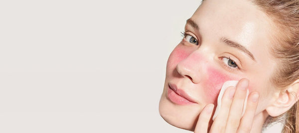 The Most Effective Products for Redness and Rosacea