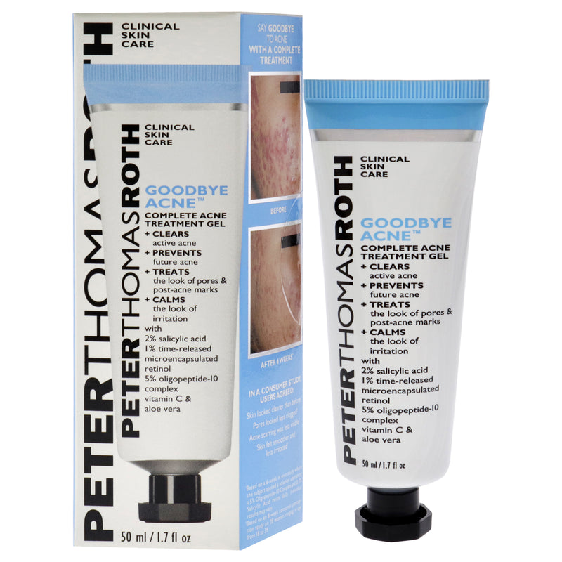 Peter Thomas Roth Good Bye Acne Complete Treatment Gel by Peter Thomas Roth for Unisex - 1.7 oz Treatment