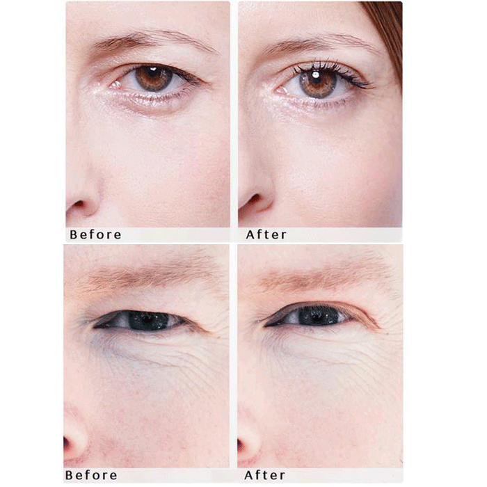 WONDERSTRIPES (S+M+L) Beauty Patches - orginal upper eyelid lifting tape