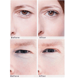 WONDERSTRIPES (M) Beauty Patches - orginal upper eyelid lifting tape